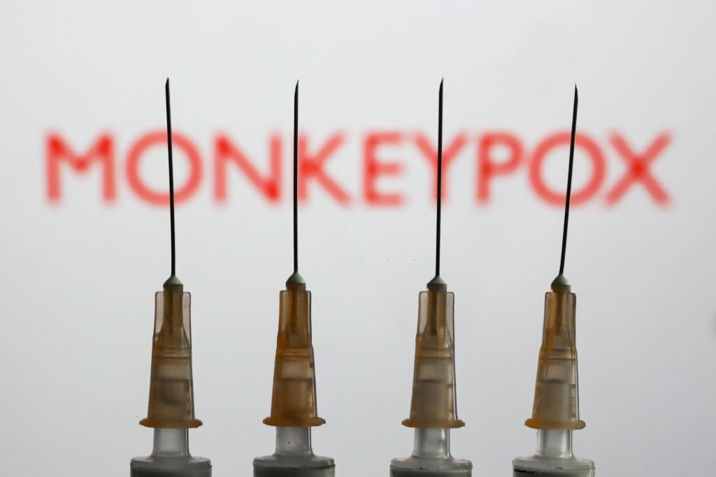 Situation of Monkey pox being monitored: Health Ministry