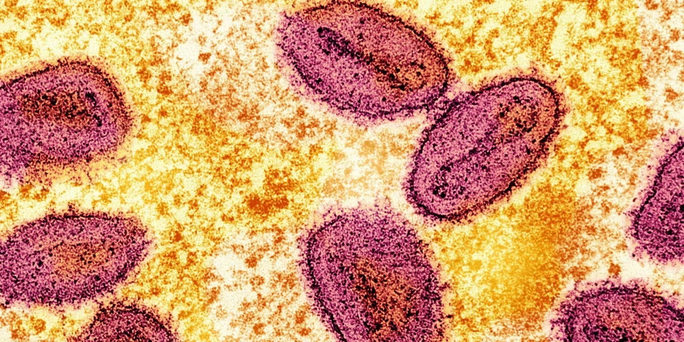 German health authorities say they have discovered a new variant of the Mbox virus

 – Newsad